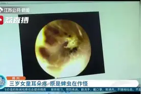 三岁女童耳朵疼 医生从耳道里取出一只活蜱虫，都已产卵视频封面