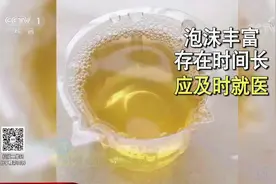 生活圈：尿液有沉淀物或有泡沫，是不是身体出现了异常？专家解答视频封面