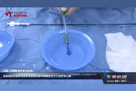 北部战区总医院完成全军首例生物可降解技术介入治疗先心病视频封面