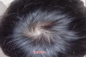 孩子头上的“旋”代表了啥？你家的宝宝头上有几个旋？视频封面