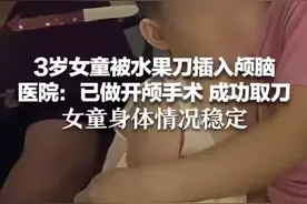 云南“头上插刀”女童后续：已手术成功取刀，身体情况稳定图片