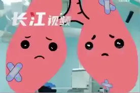 男子患罕见肺泡蛋白质沉积症，肺灌洗术洗出十几斤“牛奶”图片