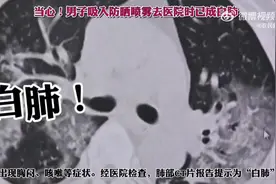 【停止错误操作！#男子吸入防晒喷雾就医时已变白肺#】图片