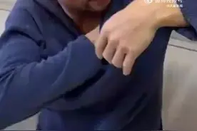 男子身上发痒检查后确诊肝癌图片